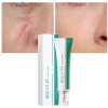 Крем для видалення шрамів і рубців від висипу вугрів Breylee Acne Scar Removal Cream